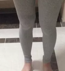 여름엔 맨 다리로 지내다가 
