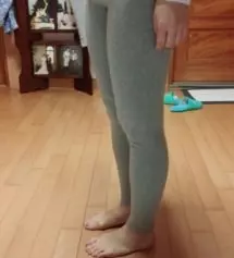 미듐 라지 계속 고민하다가 문자상담 받고 친절하게 설명해주셔서 미듐으로 결정했어요