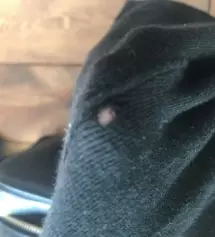 치렝스 사고 맘에 들어서 샀는데 옷에 구멍이 나서 왔어요ㅜㅜ
