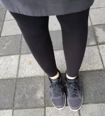 키163,임신25주 상태예요
