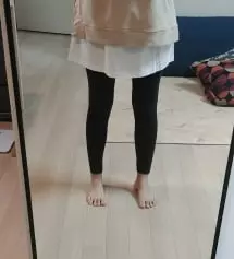 다는부분은 다 맞는데 명치가엄청 불편해요
