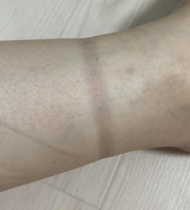 다른 돌돌이 양말 반나절도 안신었을때 사진도 첨부합니다
