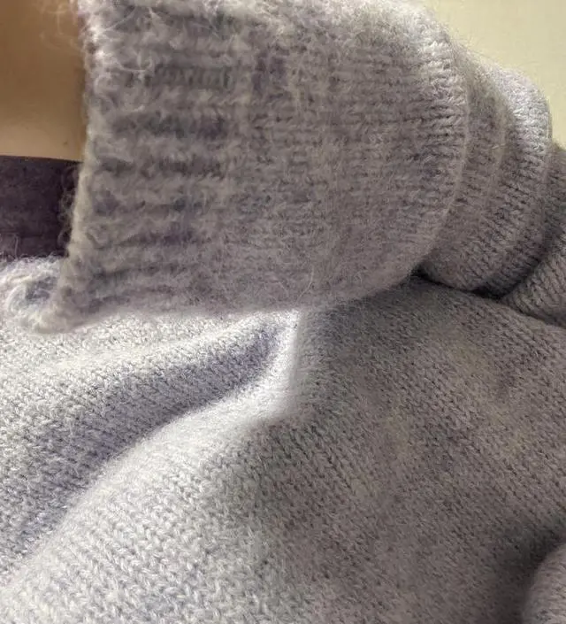 털이 너무 많이 빠져요 
