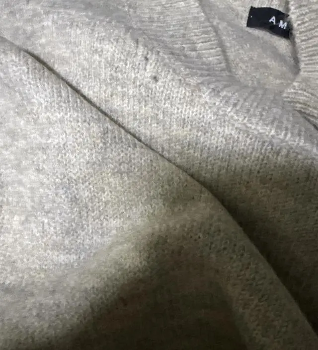 전정기가 약간씩 일어나긴하는데 
